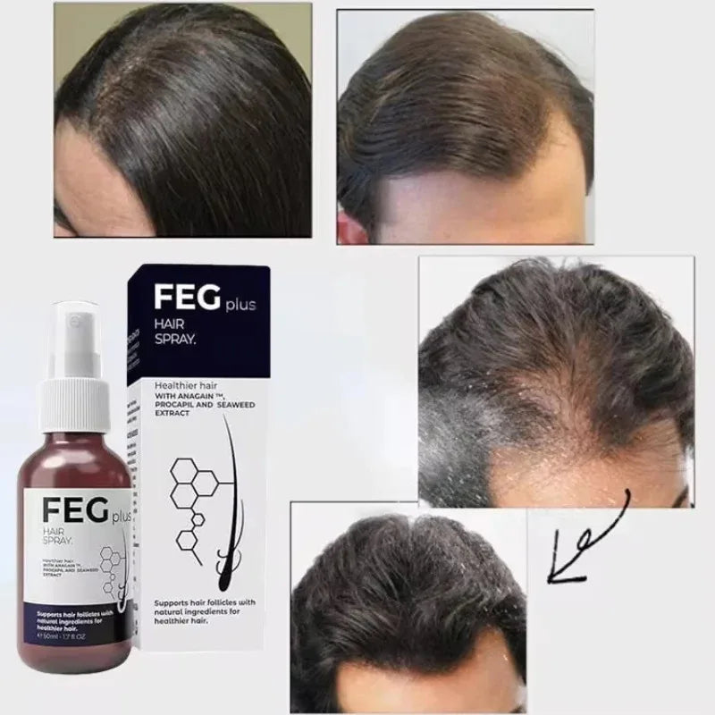 FEG PLUS Hair Growth Serum & Spray – 50ml Advanced Formula for Men & Women, Stronger, Thicker Hair